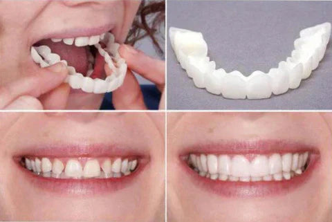 Carillas Dentales Postizas - Superiores y inferiores