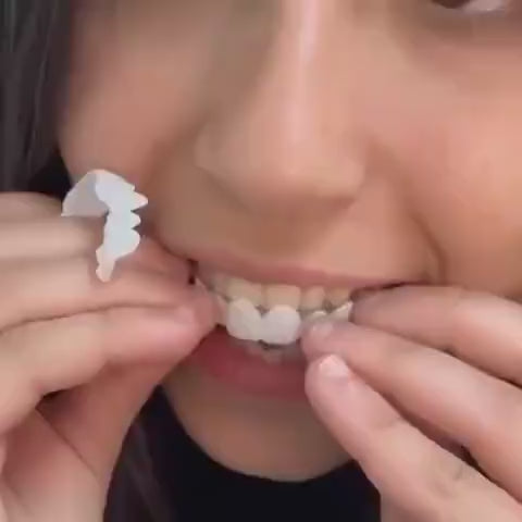 Carillas Dentales Postizas - Superiores y inferiores